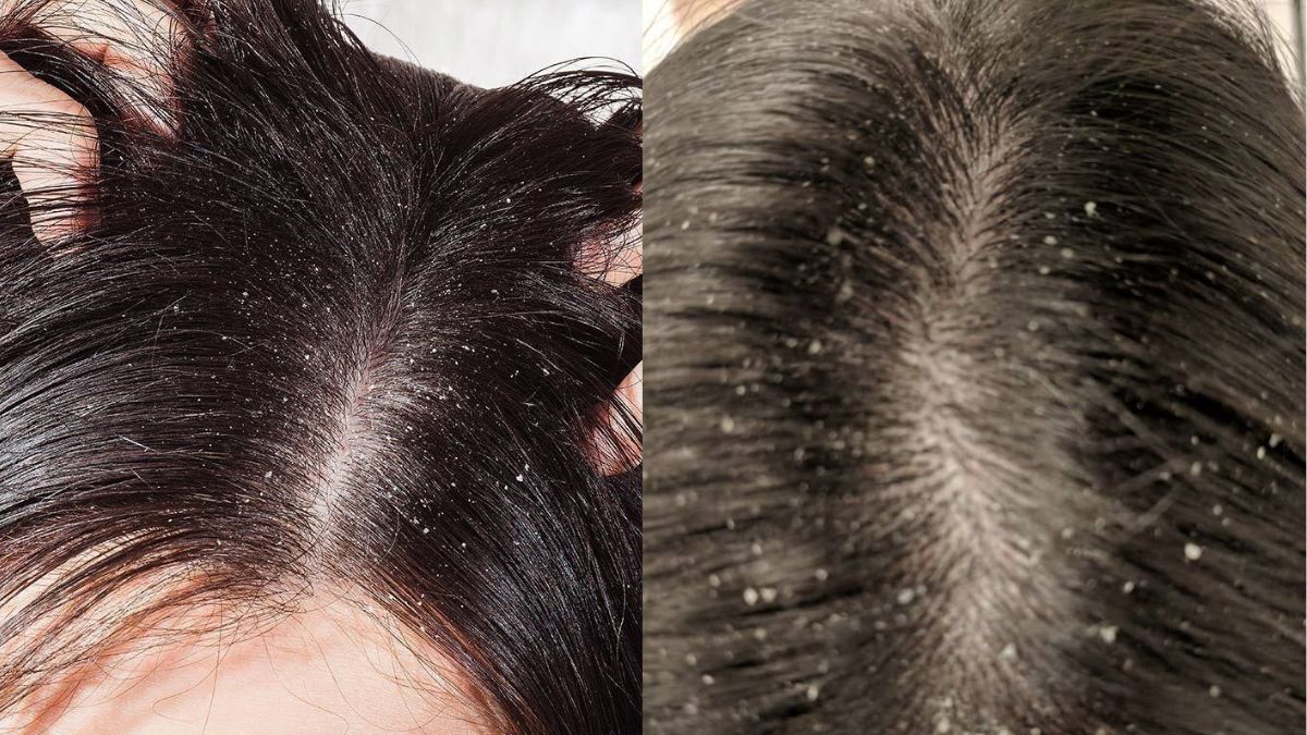 Natural Hair Care Tips